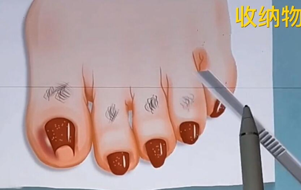 20220908113556_43745