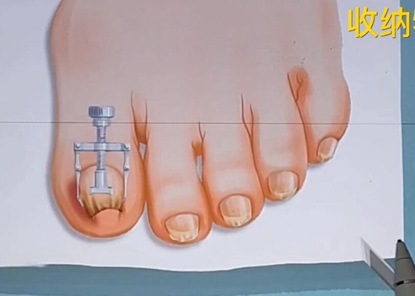 20220908113613_95710