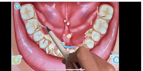 20221126154431_67002