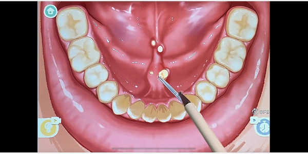 20221126154437_88853